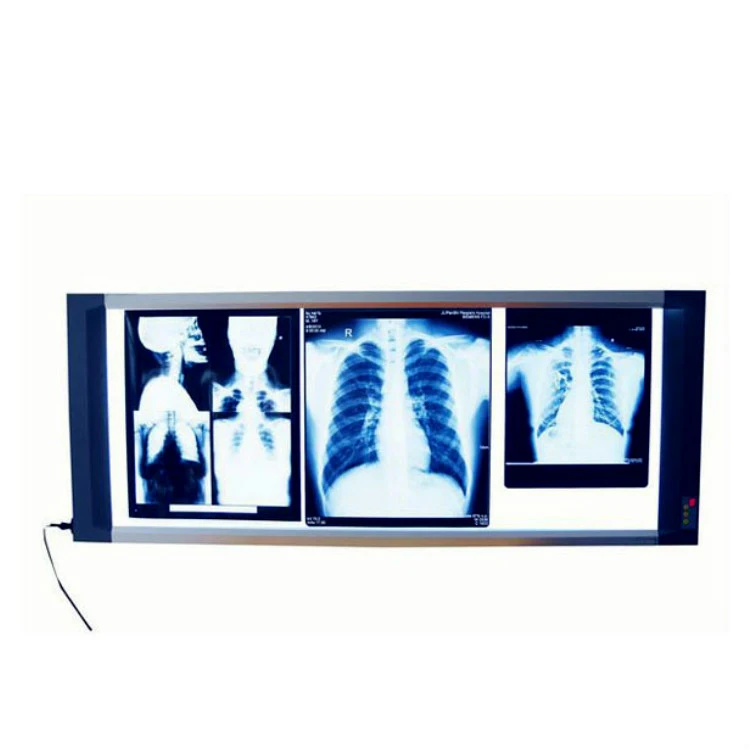 YSX1706 медицинский цифровой рентгеновский пленочный глазок с тройным подключением светодиодный рентгеновский пленочный глазок