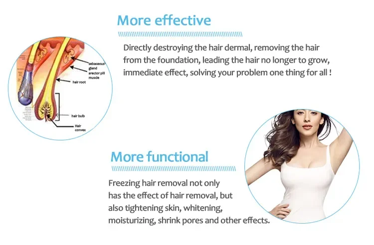 cost effective triple wavelengths 808+755+1064 epliation diode laser hair removal machine beauty machine