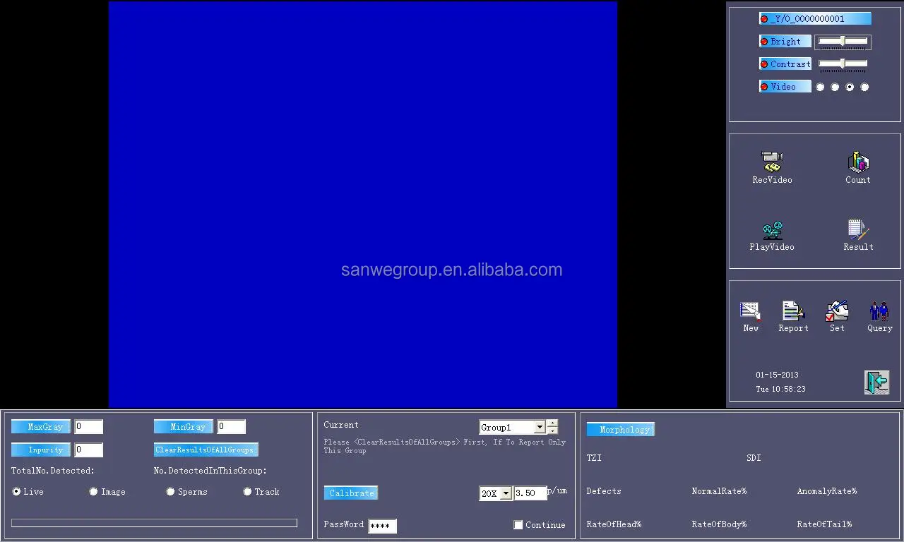 SANWE  SW-3303 Digital Colposcope   Electronic Colposcope  Colposcopy
