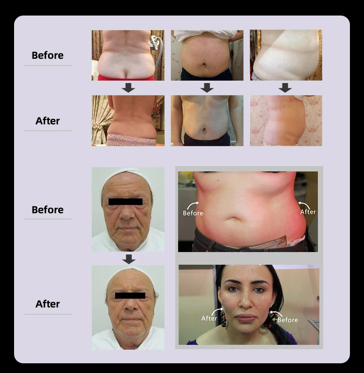 2021 new salon beauty machine Vacuum cavitation system body sculpting/skin tightening