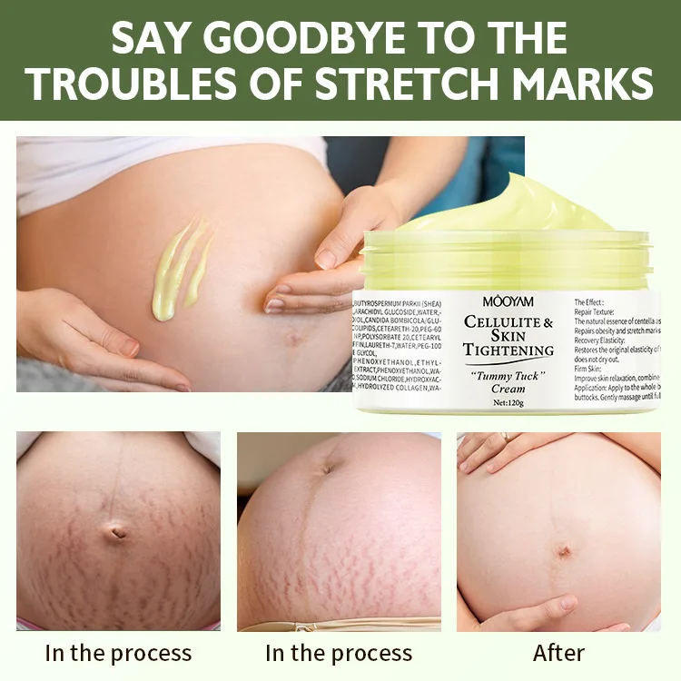 Obesity Pregnancy Line Repair Cream Firming, Nourishing, and Desalinating Postpartum Pregnancy Line Repair Cream