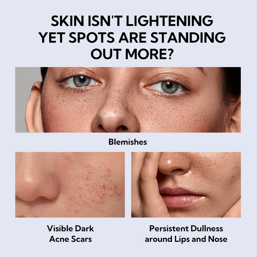 Lanbena skin care niacinamide Whitening serum for face hyaluronic acid serum