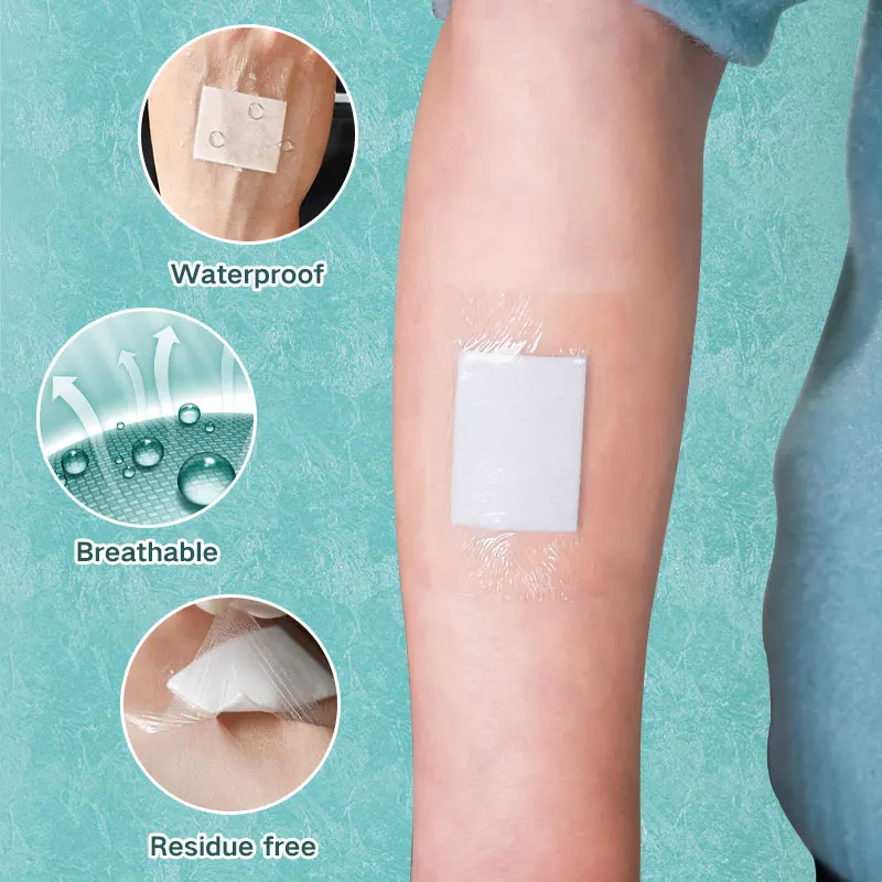 Medical consumables Wound dressing Medical waterproof absorb transparent wound pu film dressing island wound plaster