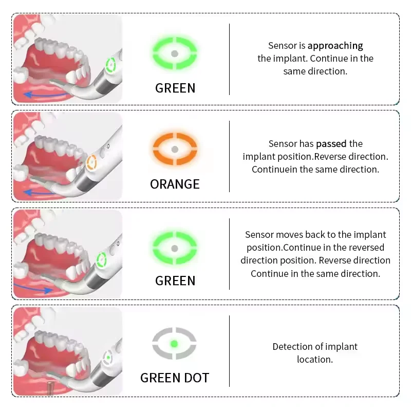 Dental Instrument Wireless Dental Implant Locator With 360 Degree Rotating Sensor Precise Locating Finder Implant Detection