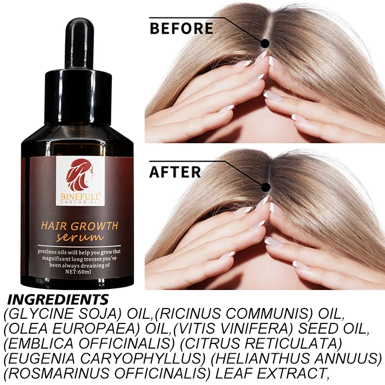 Private Label Natural Ginger Hair Growth Oil  Anti Loss Treatment Hair Oil Fast Hair Growth Serum