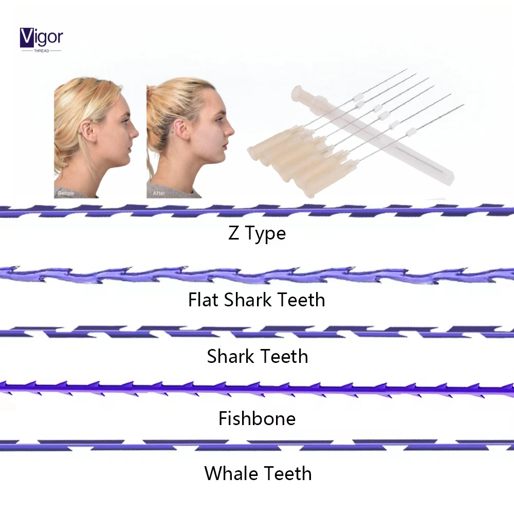 ENNA cosmetic 6d cog oem pdo threads 38mm lift pdo 6d 18g 100mm pdo hilos cog thread lift multy thread sharp needle