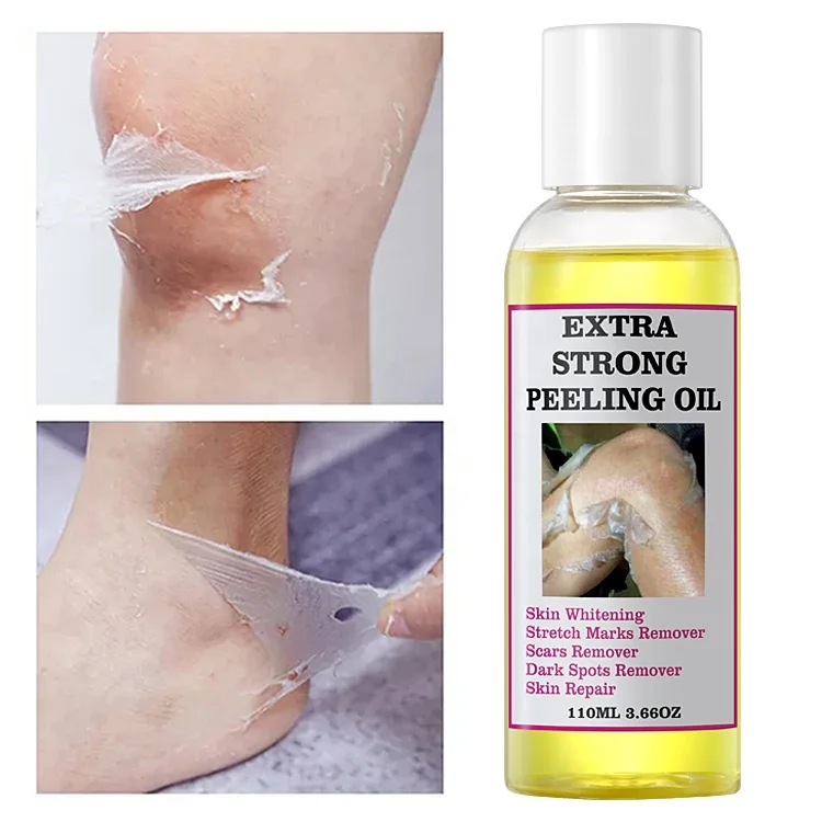 Extra Strong Peeling Oil Scar Remove Stretch Marks Whitening Yellow Peeling Oil