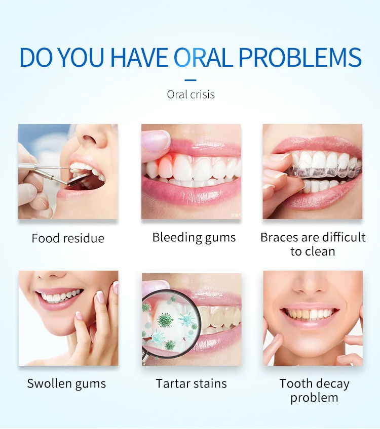 Oral Irrigator IPX7 Waterproof USB Charging Electric Teeth Whitening Dental Cleaner Travel Dental Floss Water Flosser