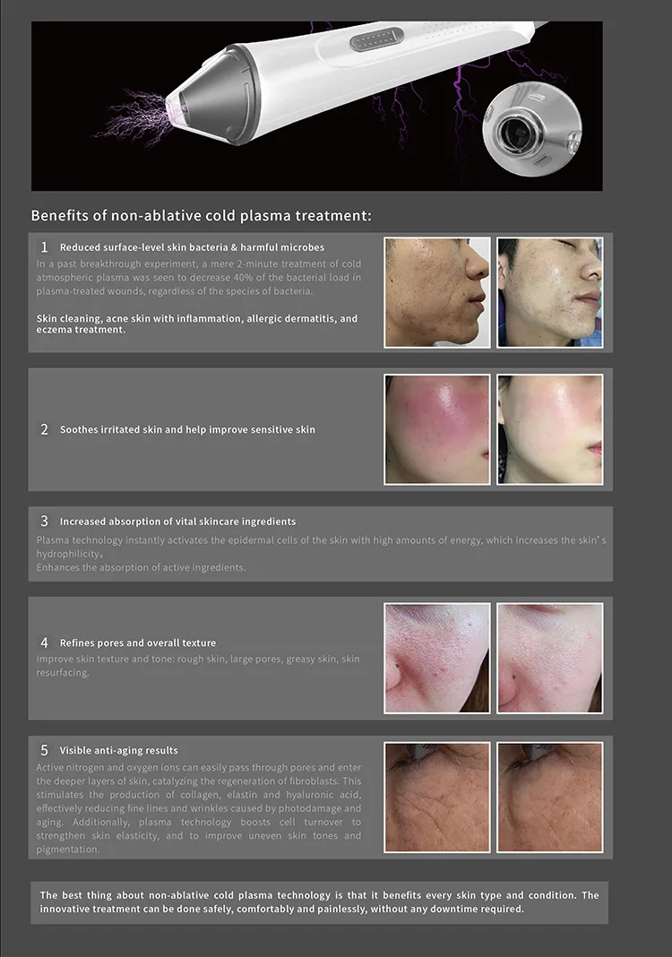 2022 RF Skin Tightening Face Lifting Micro Needle Fractional Rf Machine/micro Needle Rf Machine/leaflife Mjoinir Plasma Pen