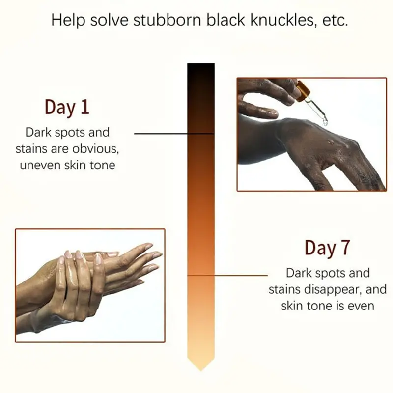 Get Rid Of Dark Knuckles In 7 Days Serum Whitening Removing Dark knuckles Serum Hand knuckle Eraser Serum for Elbow and Knee