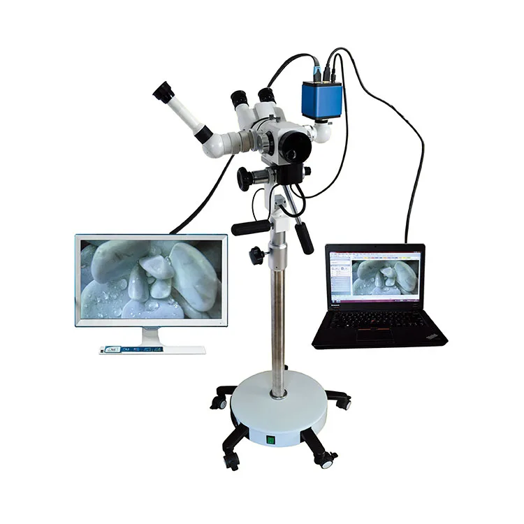 Colposcope Binocular Vision 45 Degree Optical Colposcope For Gynecology Super