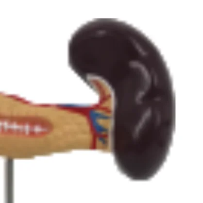 ADA  Pancreas, duodenum spleen models and Pancreatic bile duct pathological model with Pancreatic bile duct pathological model