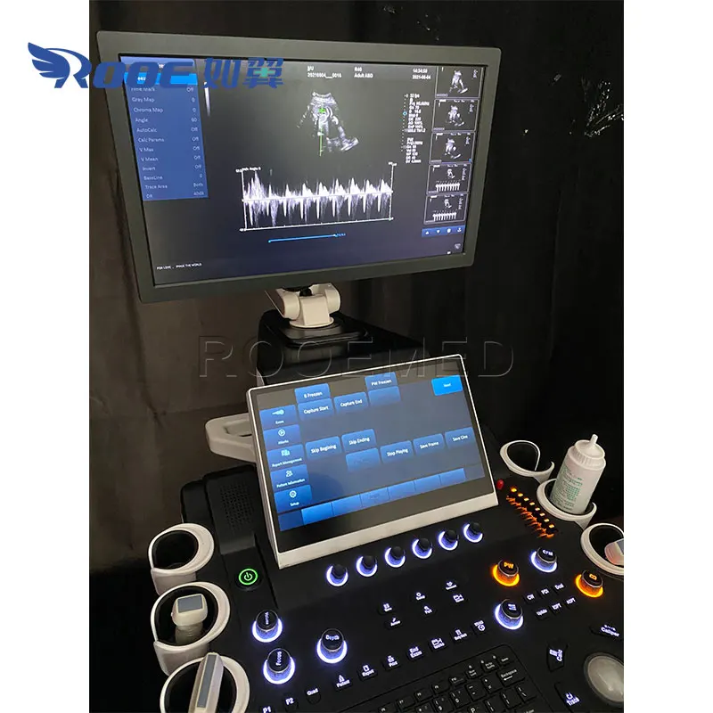 USC80 Профессиональный гинекологический допплеровский ультразвуковой аппарат 4D RealSkin 5D с тележкой