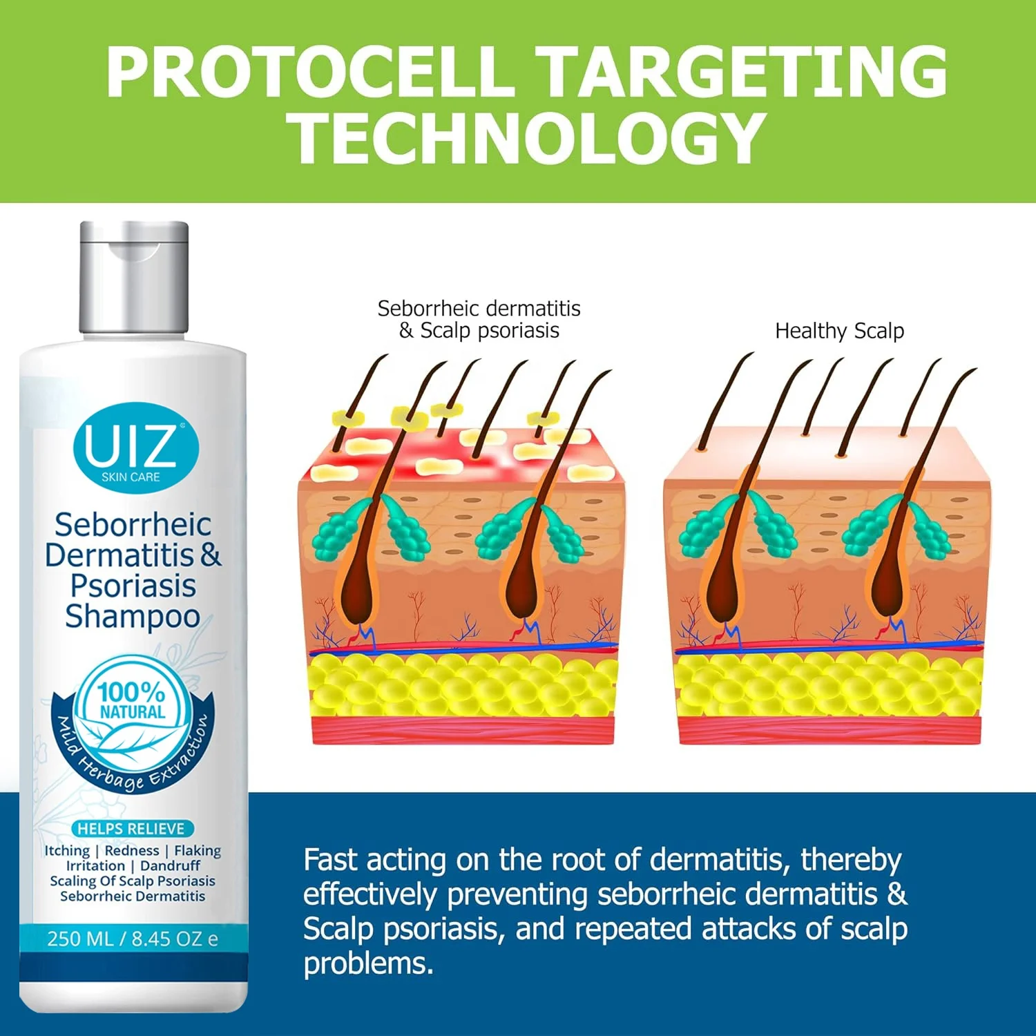 Folliculitis Psoriasis Shampoo Deep Cleaning Anti Dandruff Scalp Seborrheic Dermatitis Dry Itchy Treatment Hair Shampoo