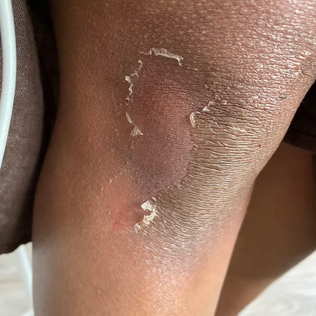 Private Label Extra Strong orange extra strong Peeling Oil Whitening Yellow Peeling Oil