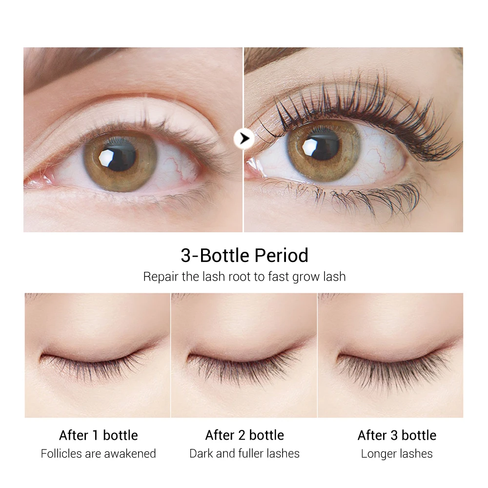 
BREYLEE professional nourish and lengthen eyelash growth serum enhancer free shipping 