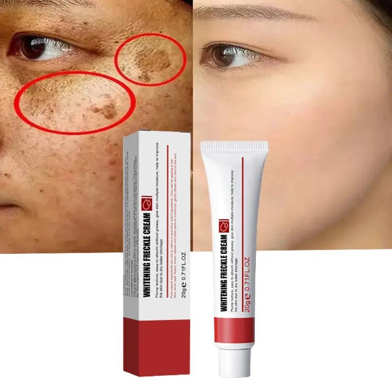 Private Label Freckles Removal Whitening Face Dark Spot Remover Corrector Cream