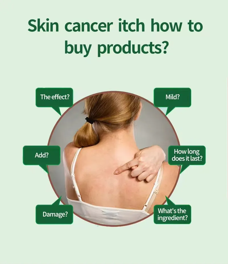 Natural Chinese Plant Face Body Cream Anti-Itch Eczema Dermatitis Inflammation Rashes Treatments Psoriasis Skin Ointment 30G