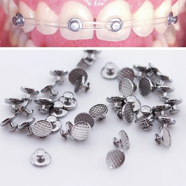 orthodontic dental brackets buccal tube arch wire Molar bands elastic rubber bands