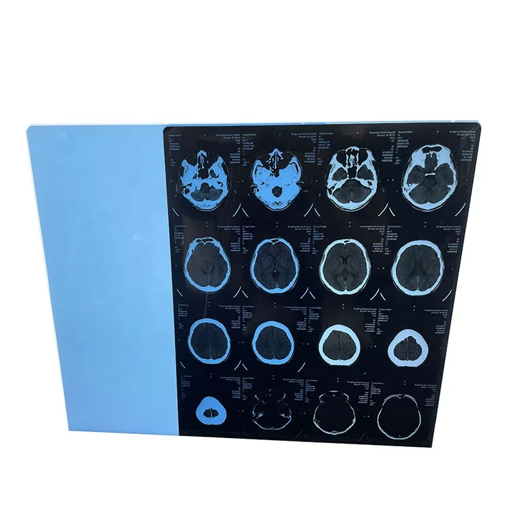 Bule X-ray thermal medical film used to printing the digital result of CR CT MRI etc with AGFA drystar 5302 dry printer