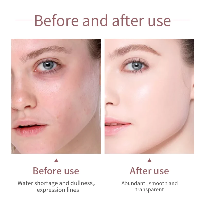 Korean Best Skincare Products Private Label Skincare Kit Manufacturer Moisturizing Mini Travel Size Rose Skincare Set For Face