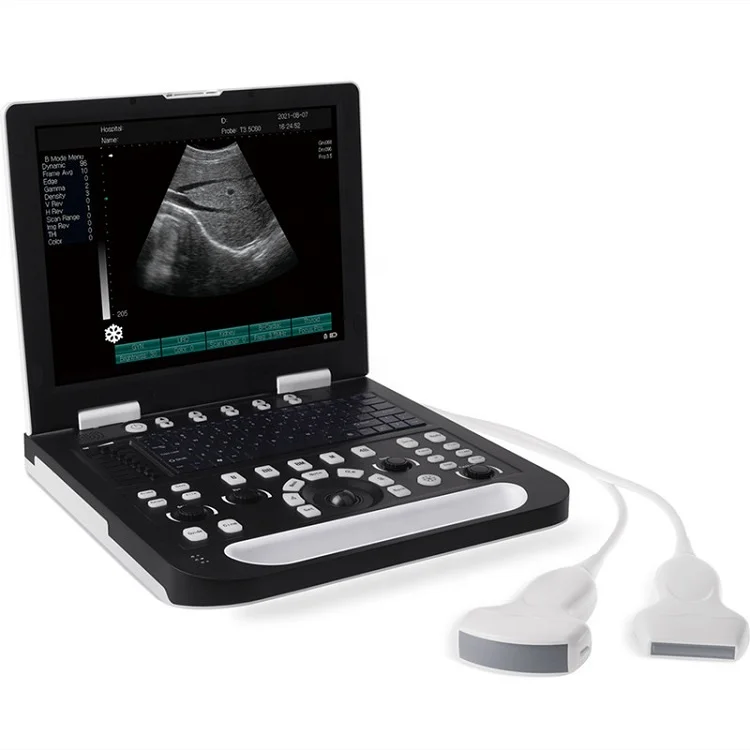 15 inches ultrasound scanner sonostar hand held ultrasound scanner with convex probe and linear probe