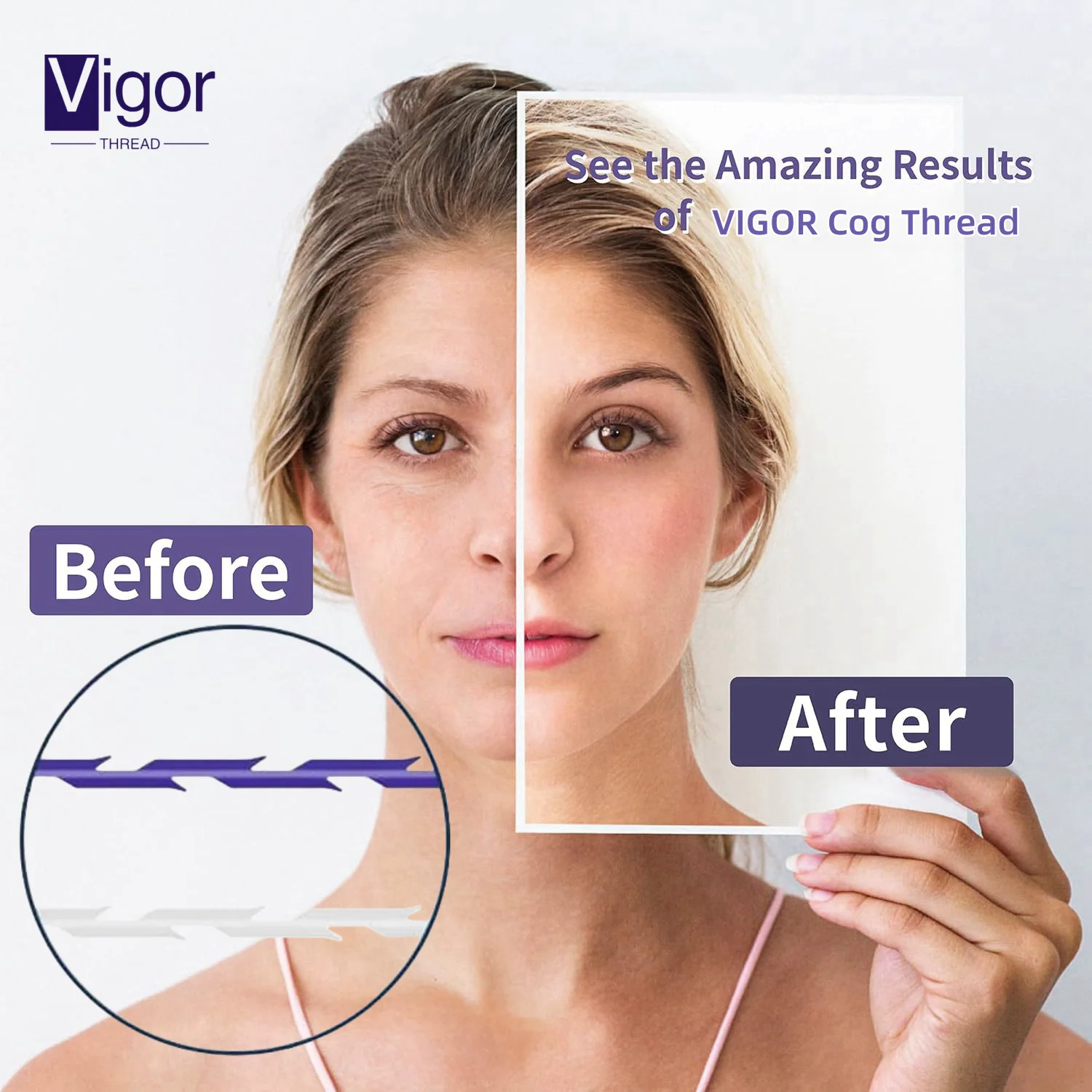 VIGOR hilos pdo eye korean hilos fishbone cog 8d 18g 100mm 21g 100mm hilos v lift mono small screw fishbone thread mono screw