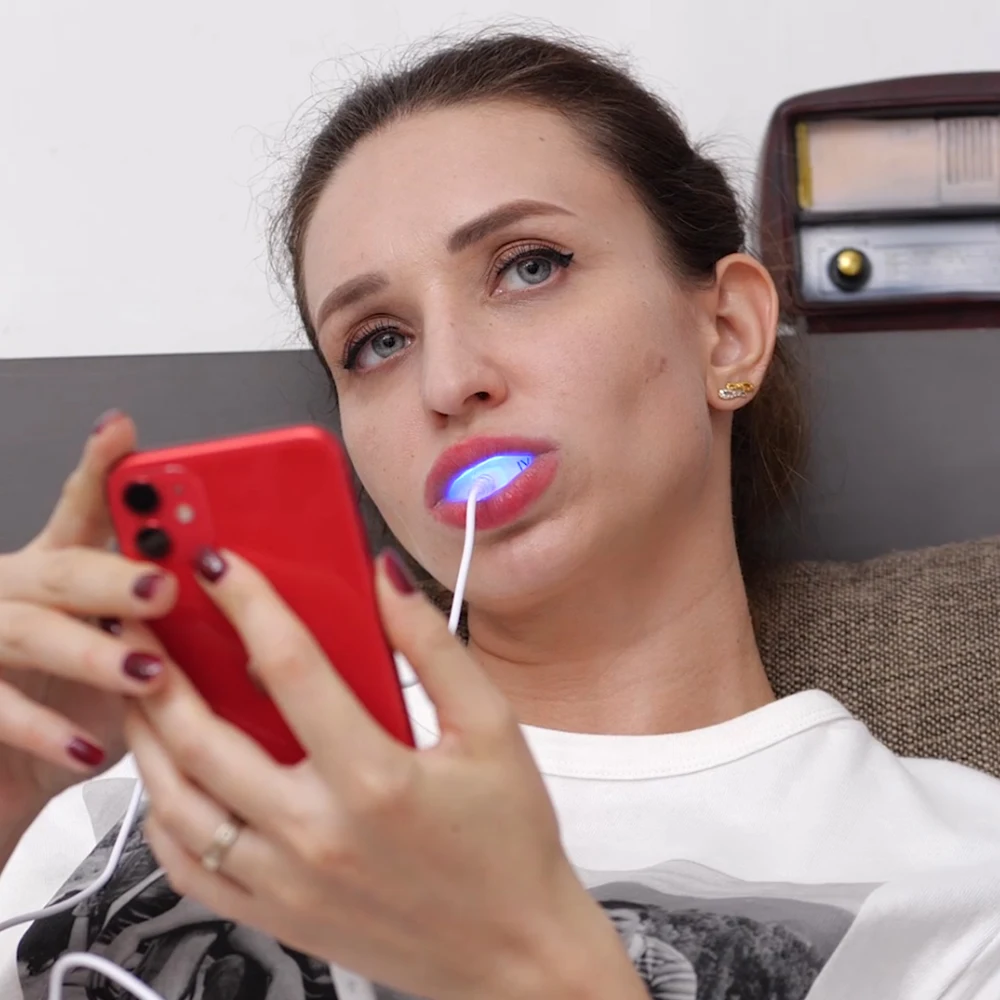 IVISMILE  Wholesale Best Selling Private Label Luxury Home Teeth Whitening Kits