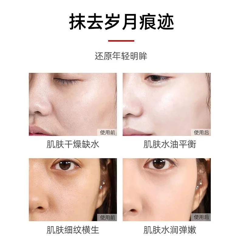Chinese Brand Professional Improve Eye Bags Beauty Cosmetics Product 35ml Skin Care Face Ginseng Snake Venom Polypeptide Serum