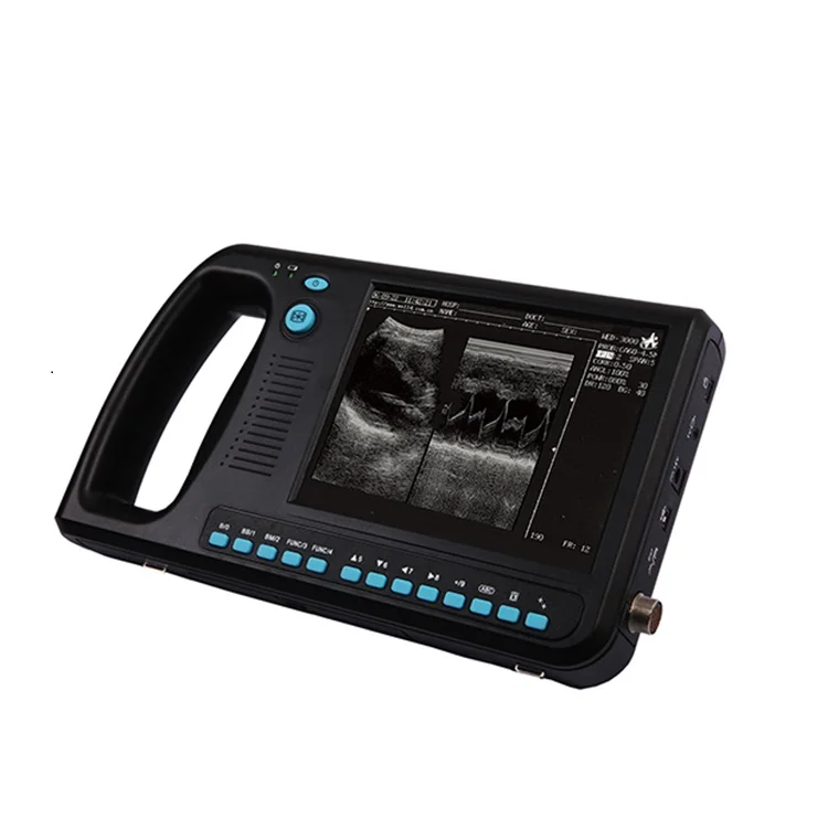 YSB3000V veterinary digital palmsmart ultrasound scanner portable ultrasound machine convex and linear transverginal
