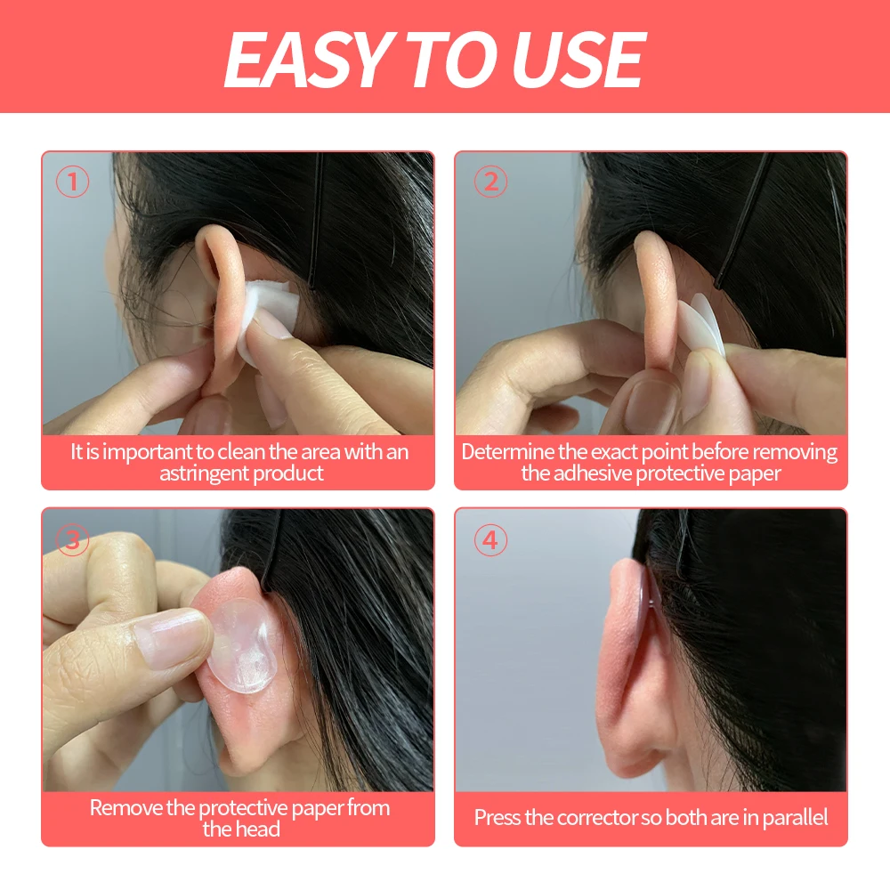 Baby Ear Corrector Solve Big Problem with Ear Stickers Pinning Back Ears Prominent Correctors
