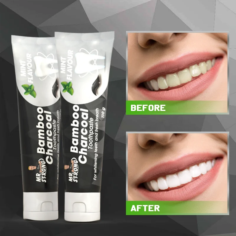 Black Color Fluoride Protect Charcoal Toothpaste