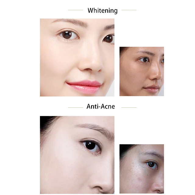 Korea Skincare Full Effect Snail Whitening Miost Nourishing Face Skin Cream In Dubai