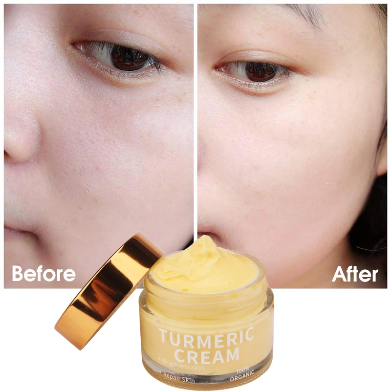 Private Label Organic Skin Care Whitening Moisturizer Acne Black Spot Vitamin c Turmeric Face Cream