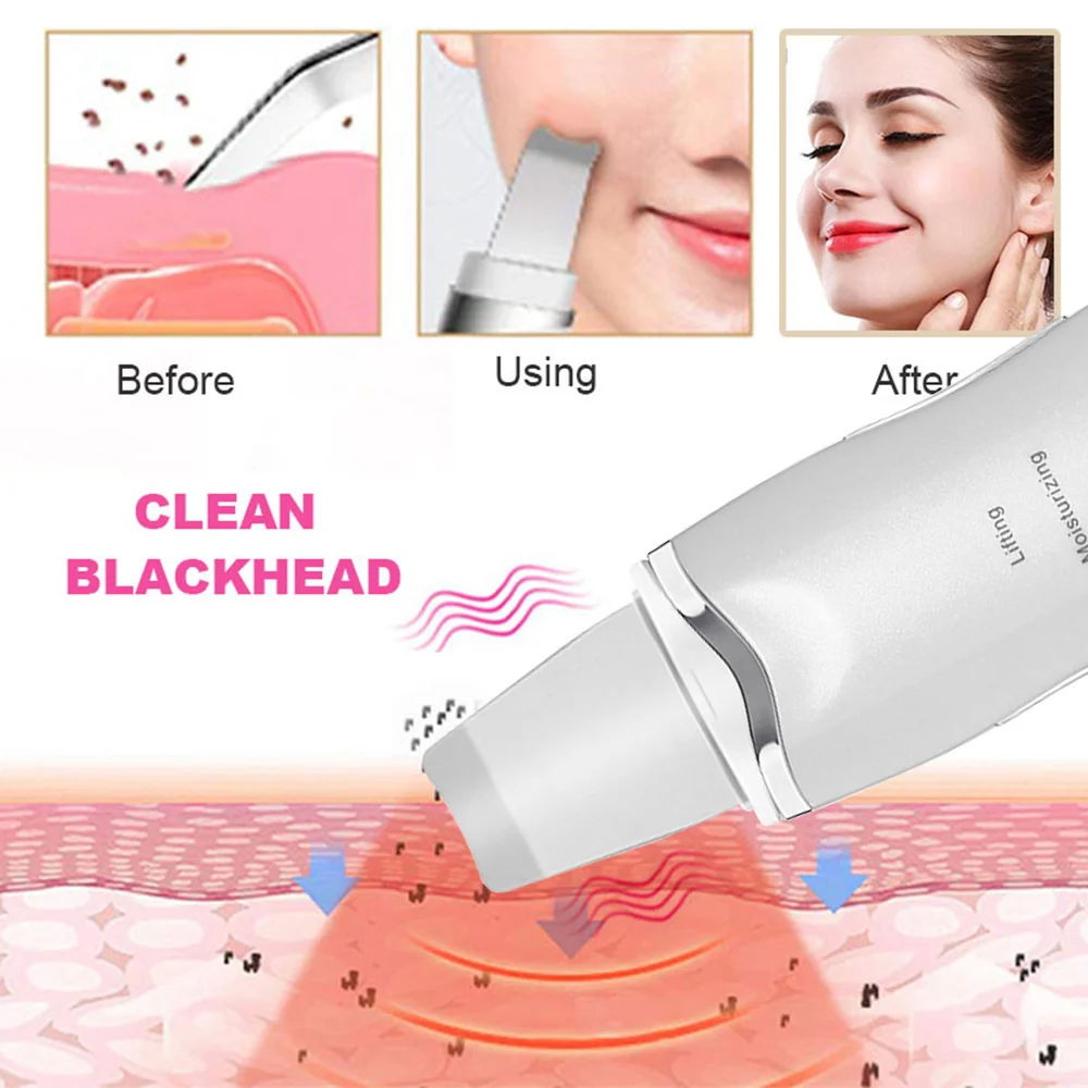 2022 Electric facial dead skin peeling professional sonic cleaning ultrasonic skin scrubber blackhead remover face spatula