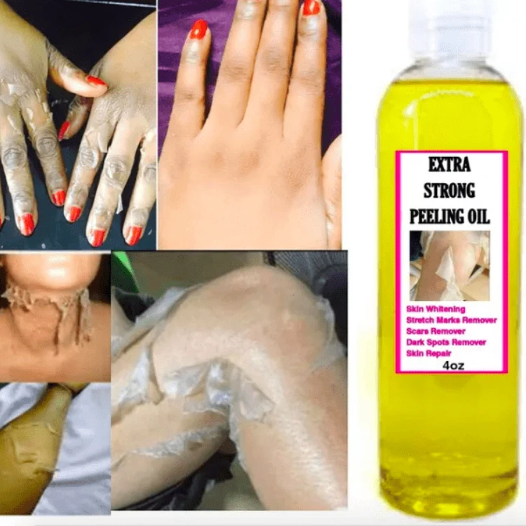 Best sale anti stretch marks multiple functions wholesale eternalelinor yellow peeling oil customized