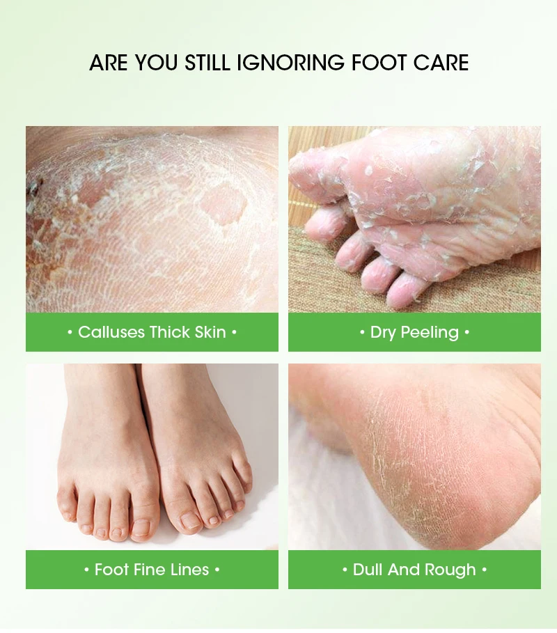 Private Brand Aloe Vera Foot Mask Exfoliating  Whitening Moisturizing Foot Care Support customized logo