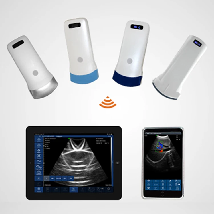 Factory price 128 elements ultrasound Scanning Probe Wireless Mini Ultrasounder linear convex ultrasound machine