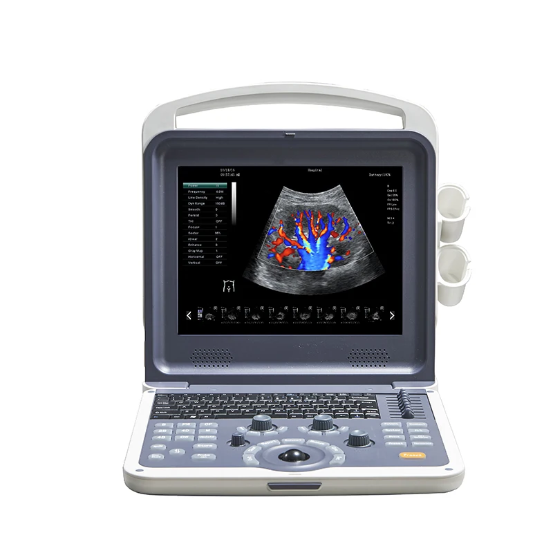 Portable Color Doppler Ultrasound with Convex and linear probes