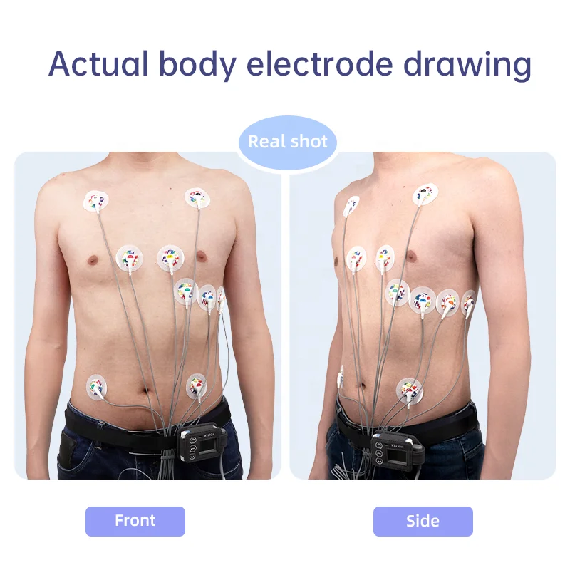 LEPU Doctor Small Holter Electrocardiogram 24 Horas Hour Ecg 12 Lead Holter Monitor From Cardiologist