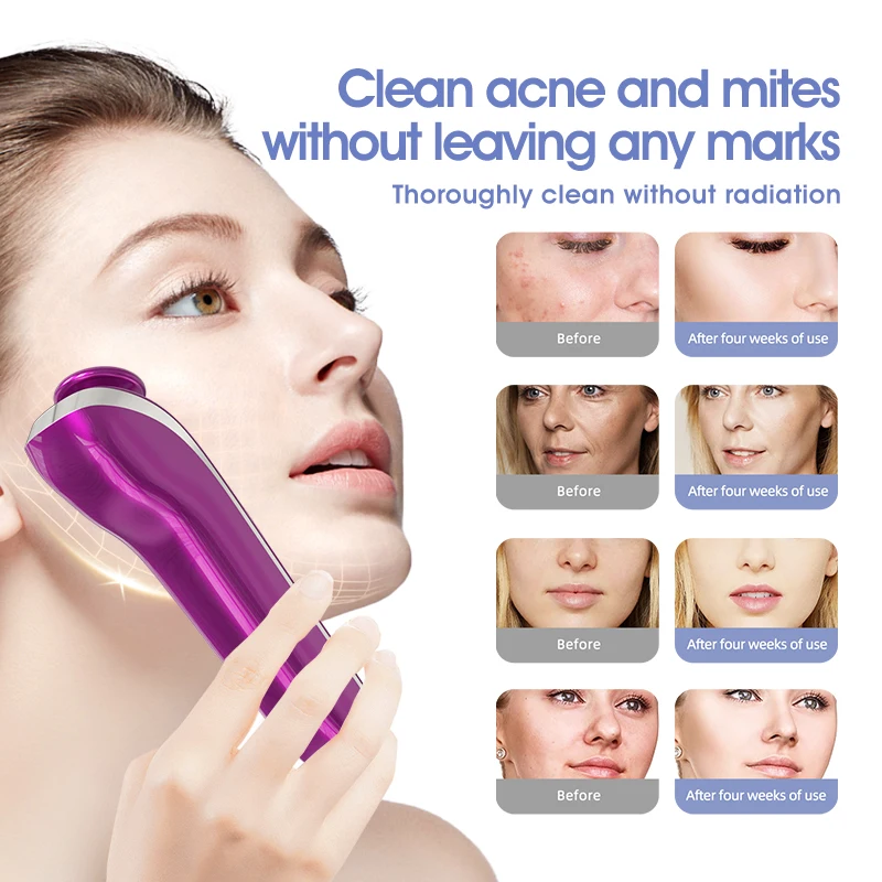 Tech gadgets electric acne remover 5 in 1 facial mite removal home care beauty device portable plasma beauty device