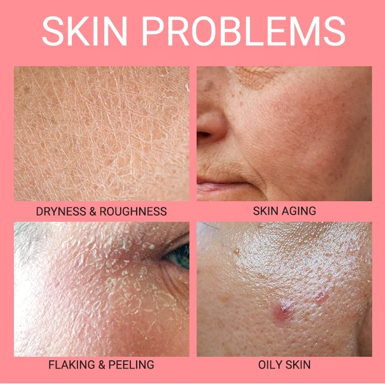 Private Label Rose Serum Lightening Collagen Whitening Moisturizing Vegan Anti-Aging Anti-Wrinkle Face Ordinary Serum