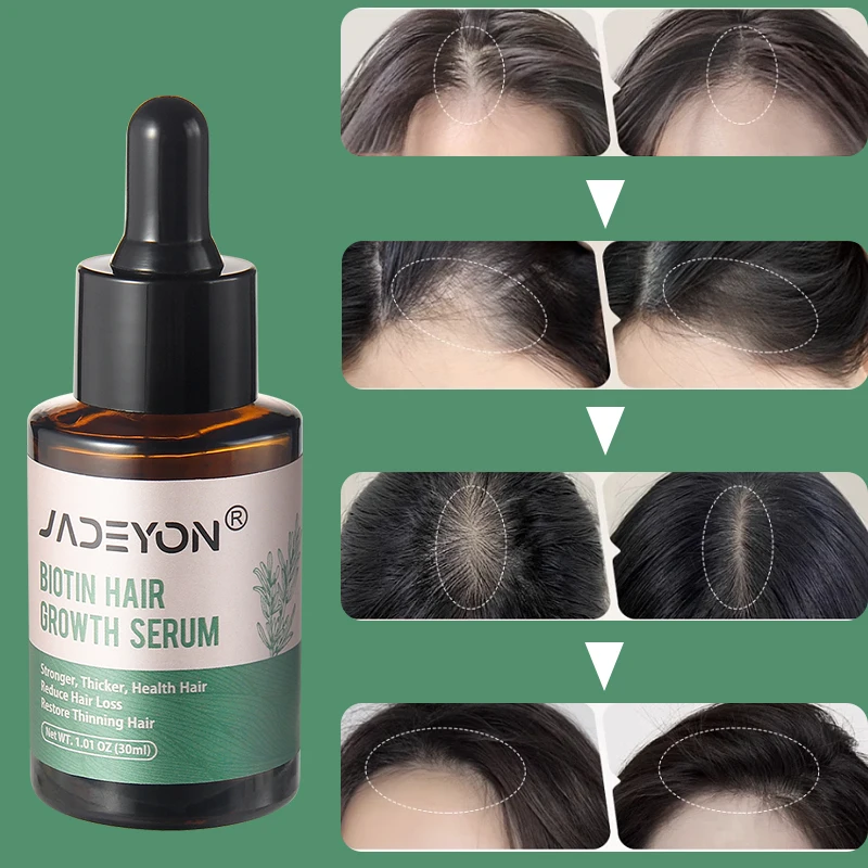 OEM Factory Organic Herbal Hair Serum Private Label Castor Oil Rosemary Mint Scalp Hair Treatment Products Hair Growth Serum