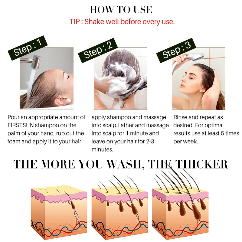 Ginger shampoo, anti-hair loss, anti-dandruff, and promote hair regrowth shampoo