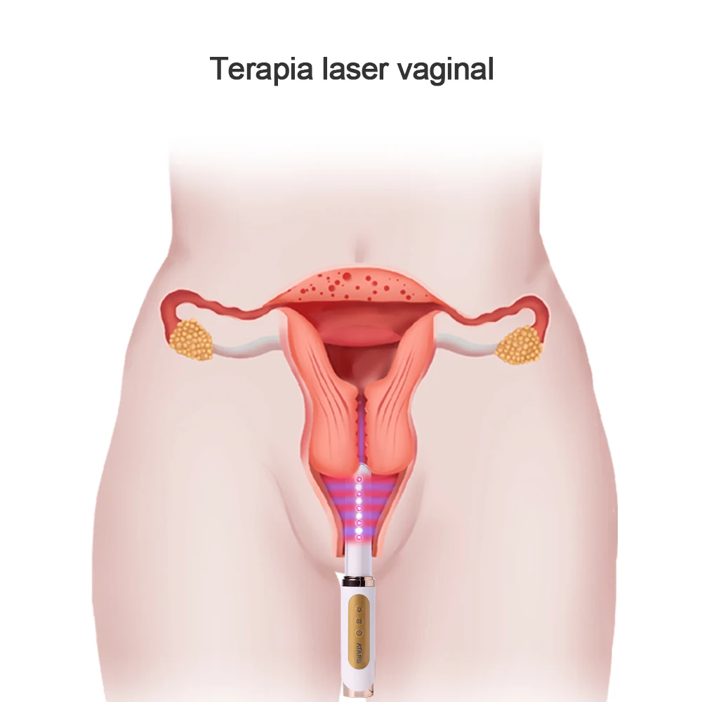 Vaginal care products Vaginal rejuvenation laser gynecological treatment increases collagen and vibrator sticks