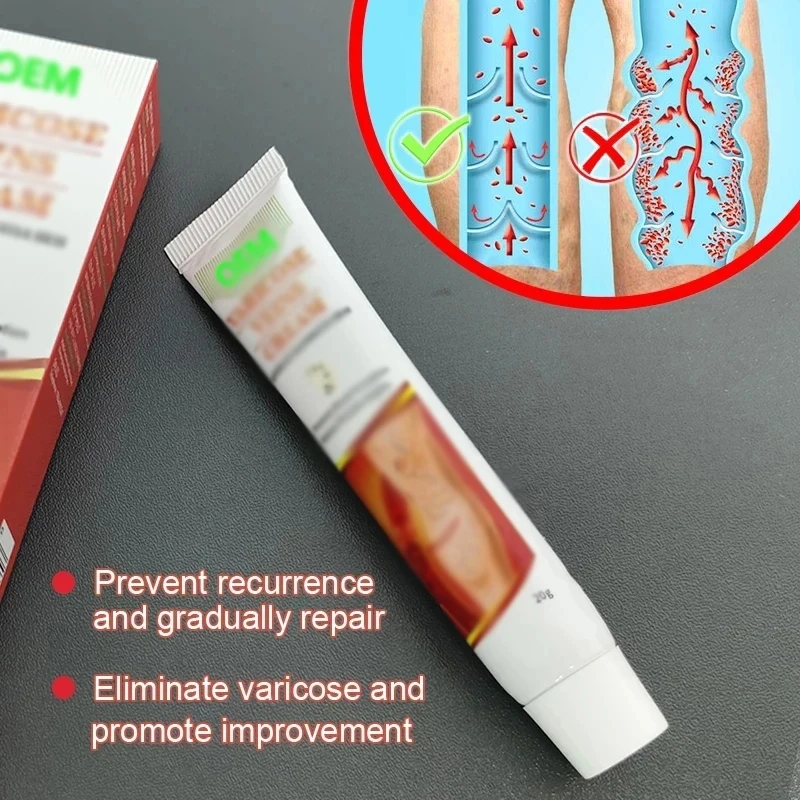 OEM Genital Scrotum Varicocele Varicose Veins Cream Varicosity Angiitis Phlebitis Leg Veins Pain Ointment