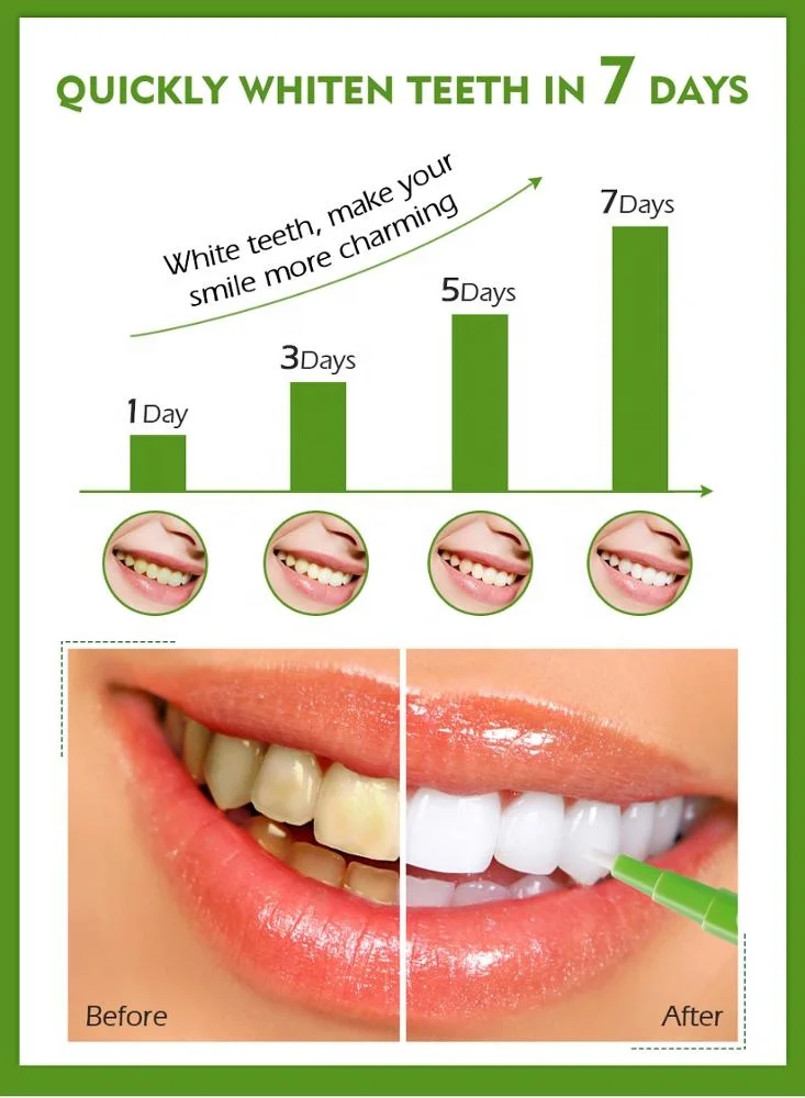 VIBRANT GLAMOUR Teeth Whitening Pen Cleaning Serum Remove Plaque Stains Protect Oral Hygiene Nursing