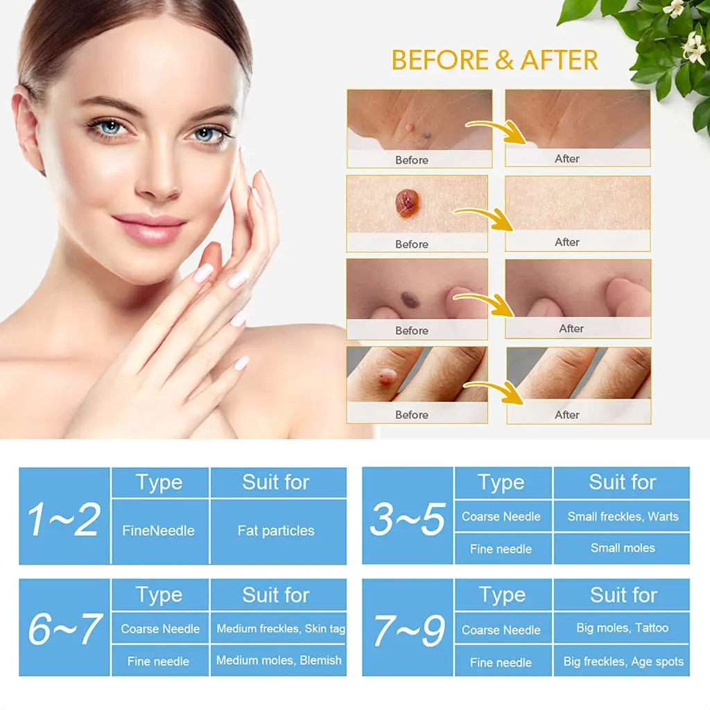 Portable Skin care home usage Skin spot mole removal Mole removal pen with Multiple Needles