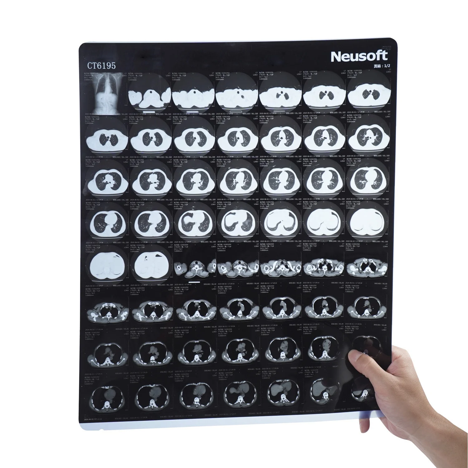 inkjet xray film 8x10 10*12 14*17  13*17 for mri machine