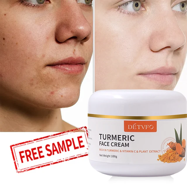 Private Label Organic Turmeric Cream Whitening Anti Acne Effect Dark Spot Brightening Turmeric Face Cream For Acne Treatment